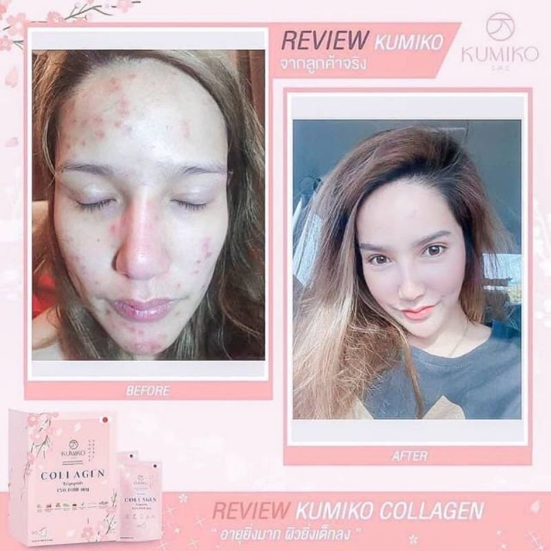 (READY) KUMIKO COLLAGEN TRIPEPTIDE 150.000mg