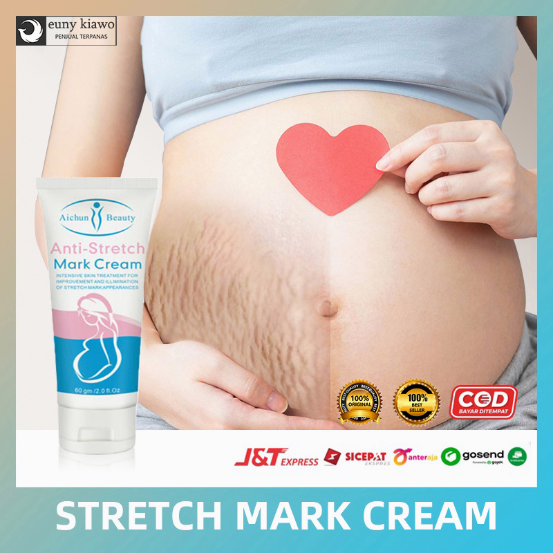 Stretch mark cream Krim stretch mark Secara efektif menghilangkan stretch mark Tujuh hari untuk menghilangkan stretch mark dengan cepat Pilihan banyak ibu