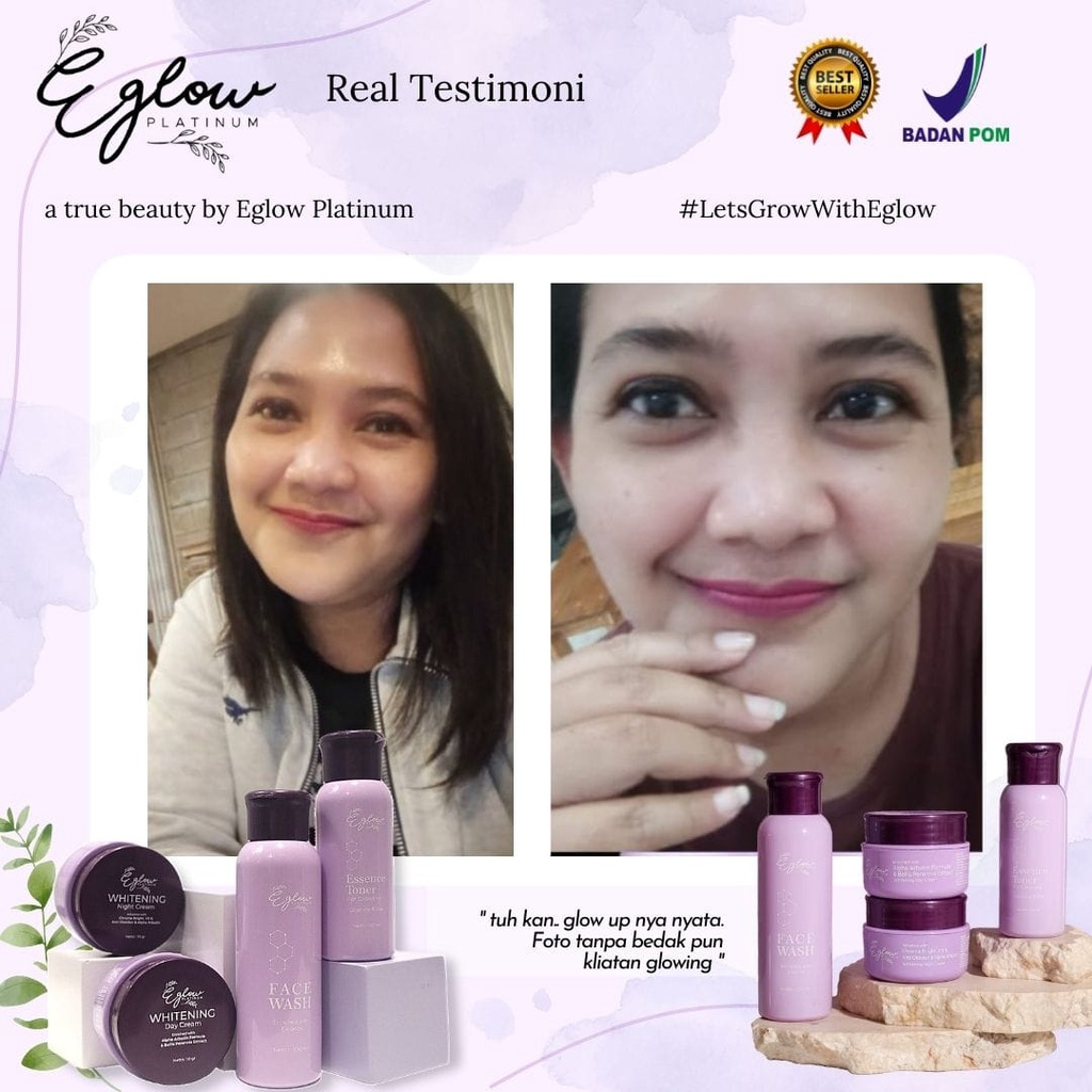 BPOM ORI | Paket Kecantikan By Eglow | Whitening | Acne | Ultimate