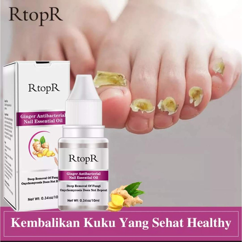 RtopR Ginger Antibacterial Nail Essential Oil Minyak Esensial Perawatan Kuku Jahe, Anti Jamur Infeksi Kuku Jari Kaki 10Ml