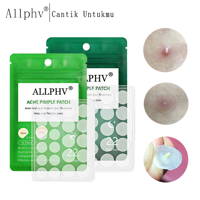 [Ori100%]ALLPHV Acne Pimple Patch/acne patches -Paket Sticker Jerawat Day (0.1mm) &amp; Night (0.3mm)