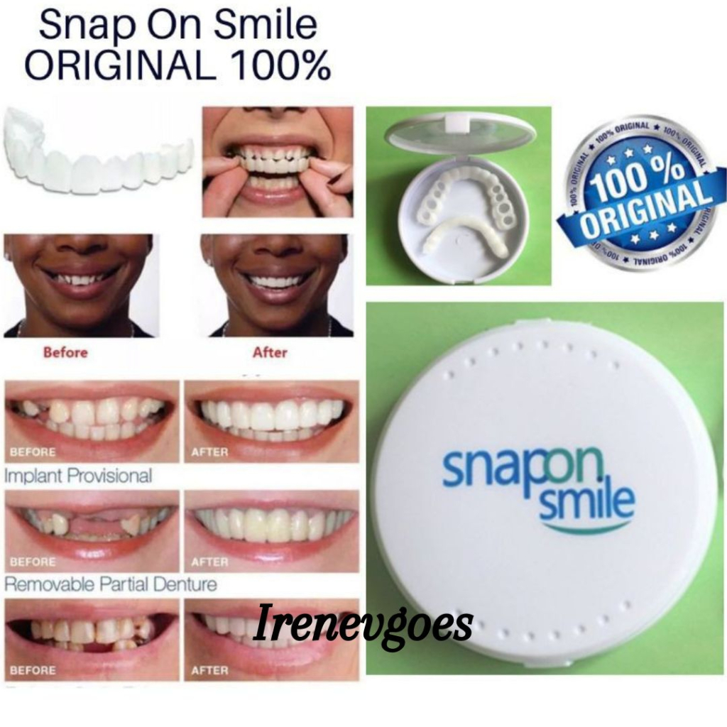 [ Bisa COD ] Original 100% Snap On Smile Sepasang Gigi Palsu Silicon 1 Set Atas Bawah - Gigi Palsu - Snap On Smile Ori