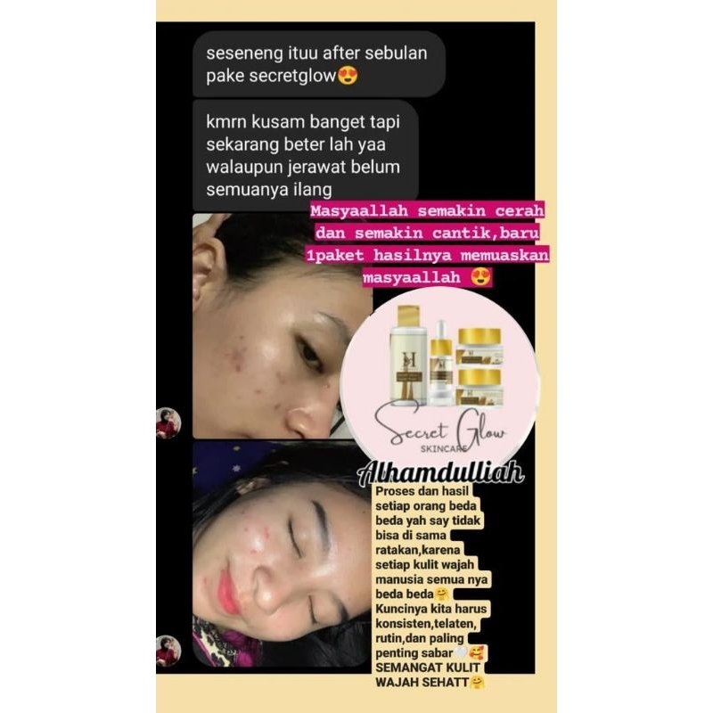 SKINCARE SECRET GLOW