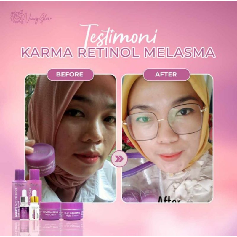 Paket Karma by Vincy Glow