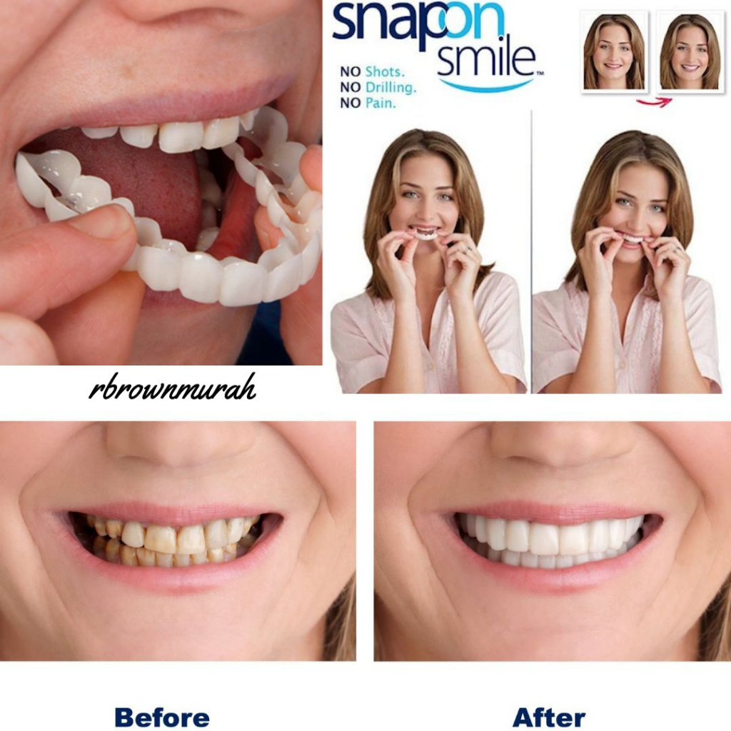 ✅[ TERMURAH ] gigi palsu instan atas bawah snap on smile original / Gigi Palsu Instan / GIGI PASANGA