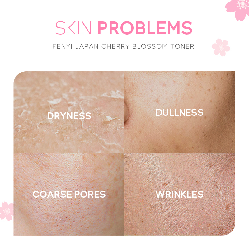 Fenyi Japan Cherry Blossom Toner Melembabkan Mencerahkan Noda Bintik-Bintik Hitam 100ml