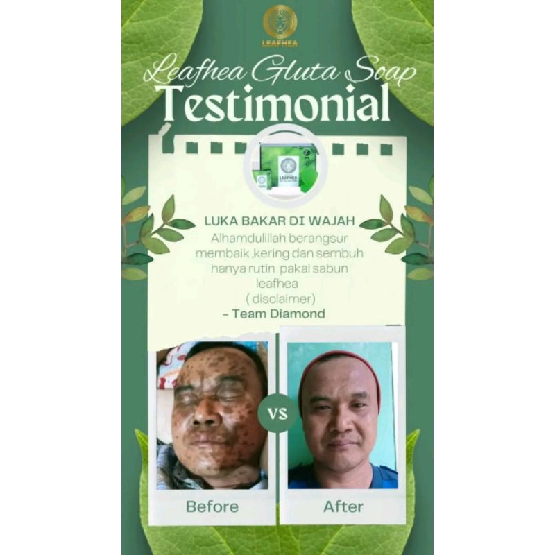 perawatan kecantikan /sabun leafhea /sabun leafhea ori / sabun leafhea ori bpom / Sabun Herbal bpom