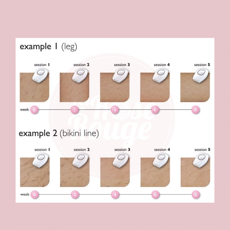 Jud Bear IPL Hair Removal Laser Portable (White)