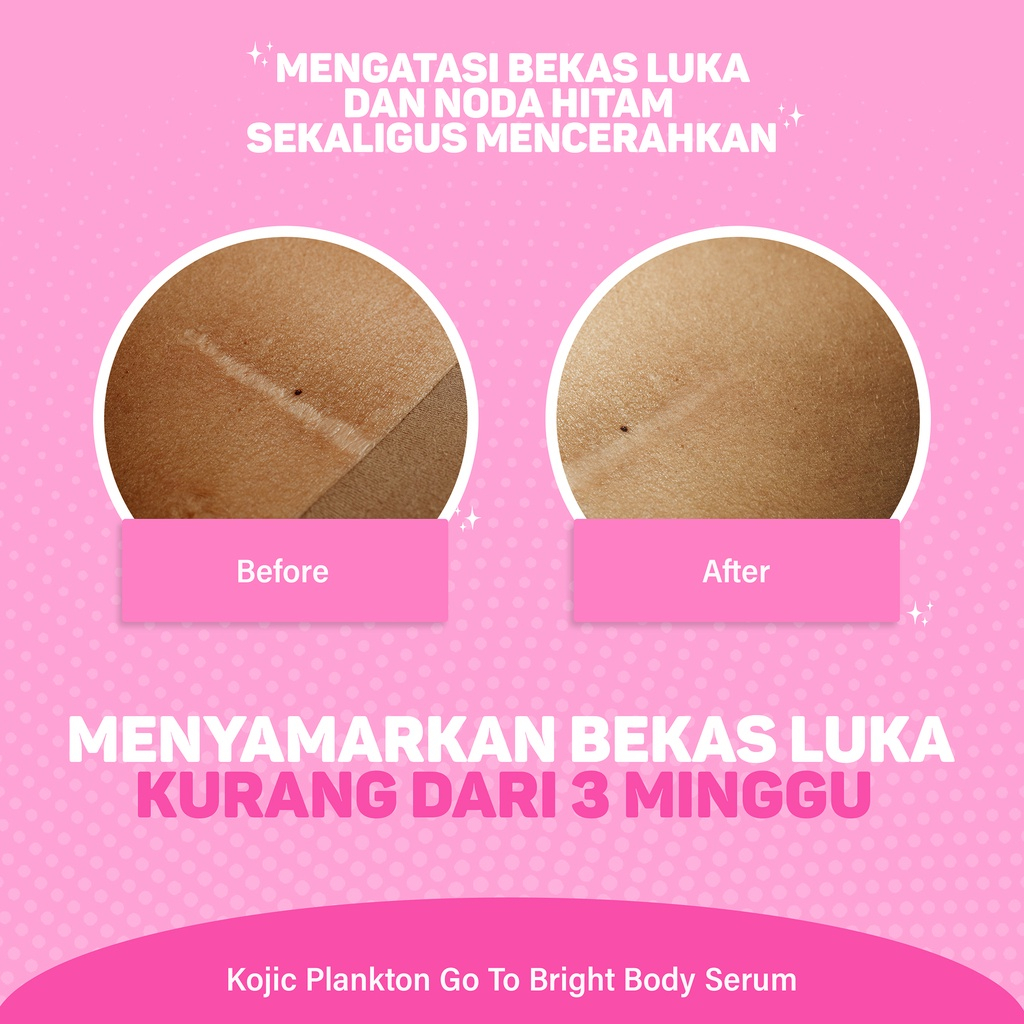 Kojic Body Serum Go to Bright | Bright &amp; Glow