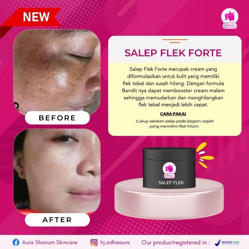 CREAM SALEF FLEK FORTE AURA SKINCARE MEMUDARKAN FLEK HITAM 100 %ORIGINAL
