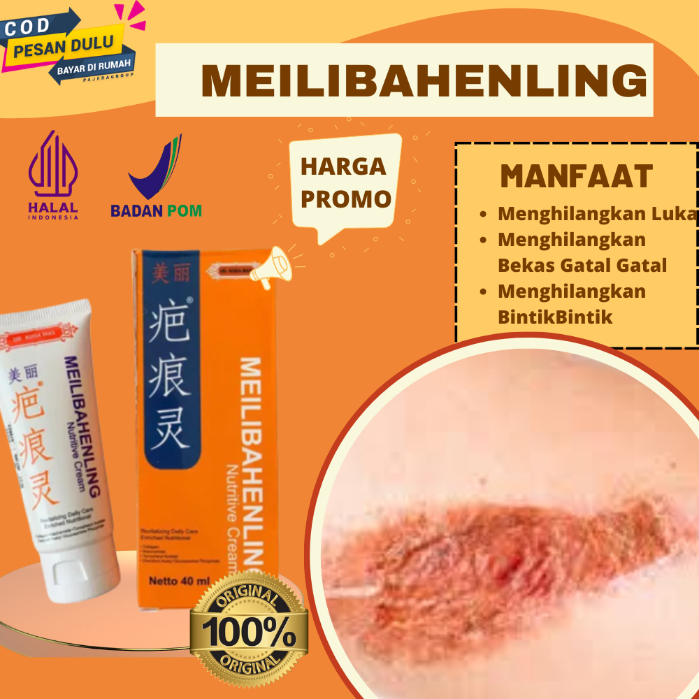 Obat Cina Herbal Mengobati Luka Bakar Bekas Knalpot,Jatuh,Kecelakaan Koreng Menghilangkan Bekas Luka