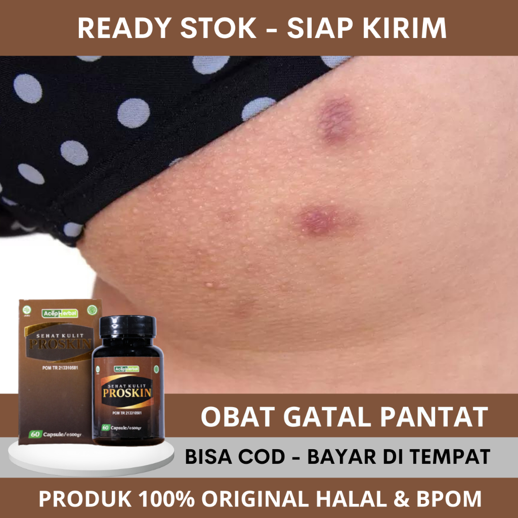 Obat Gatal Pantat, Obat Gatal Pantat Dan Selangkangan, Obat Gatal Di Pantat, Obat Pantat Burik, Obat