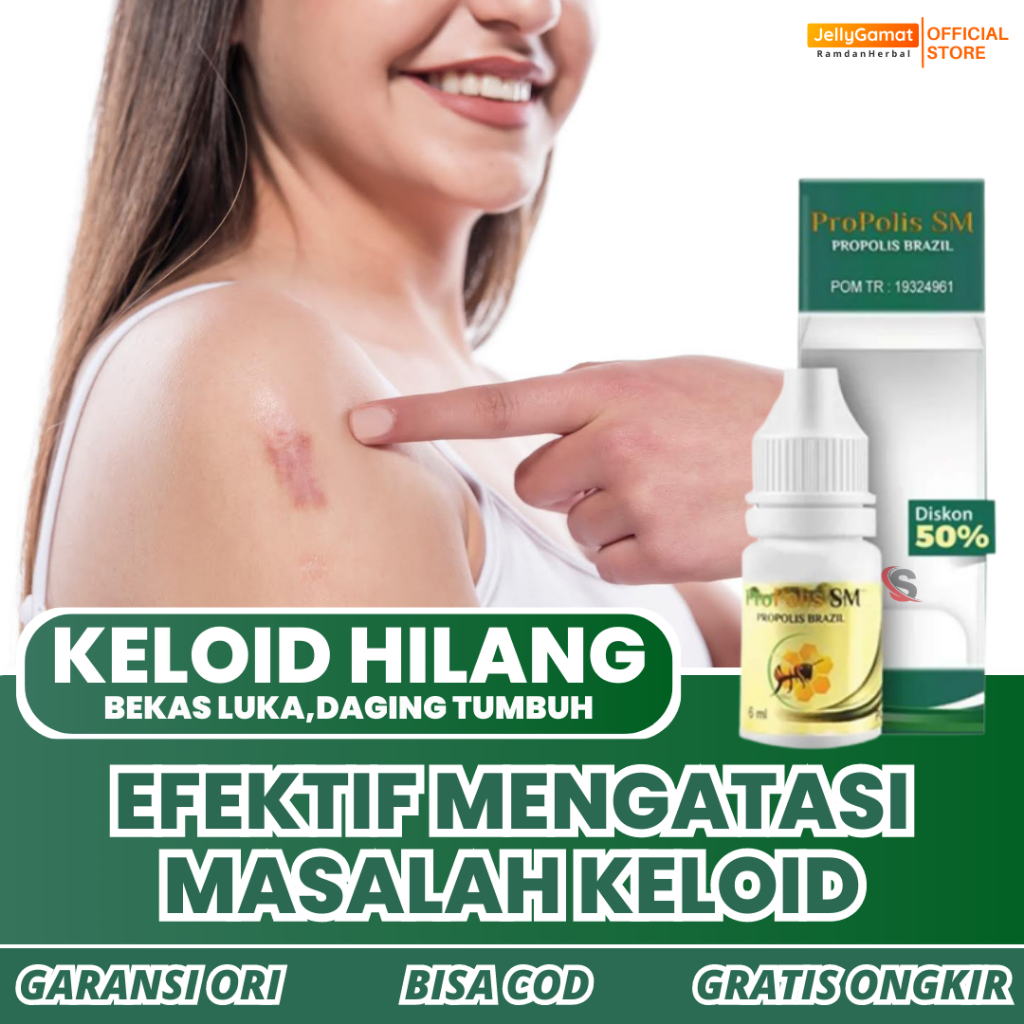 Penghilang Keloid, Obat Untuk Menghilangkan Keloid, Bekas Luka Menonjol - Propolis SM Original 100%