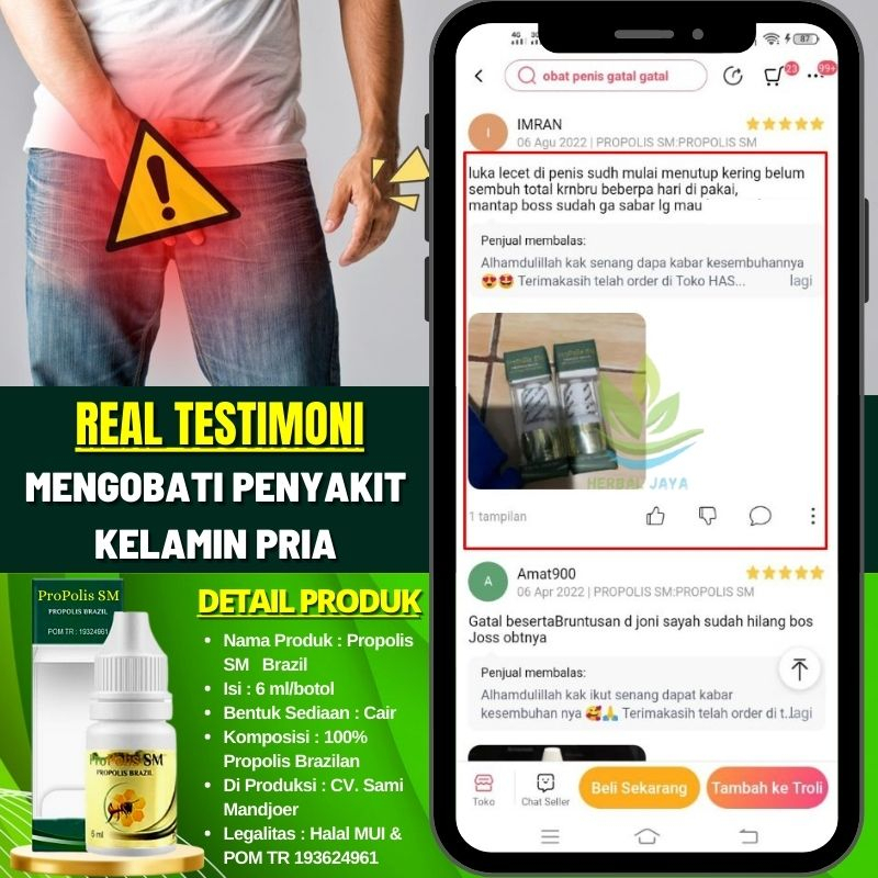 Salep Oles Penis Lecet Gatal & Perih, Obat Luka di Kepala Penis, Sariawan di Penis, Mengeringkan Luk