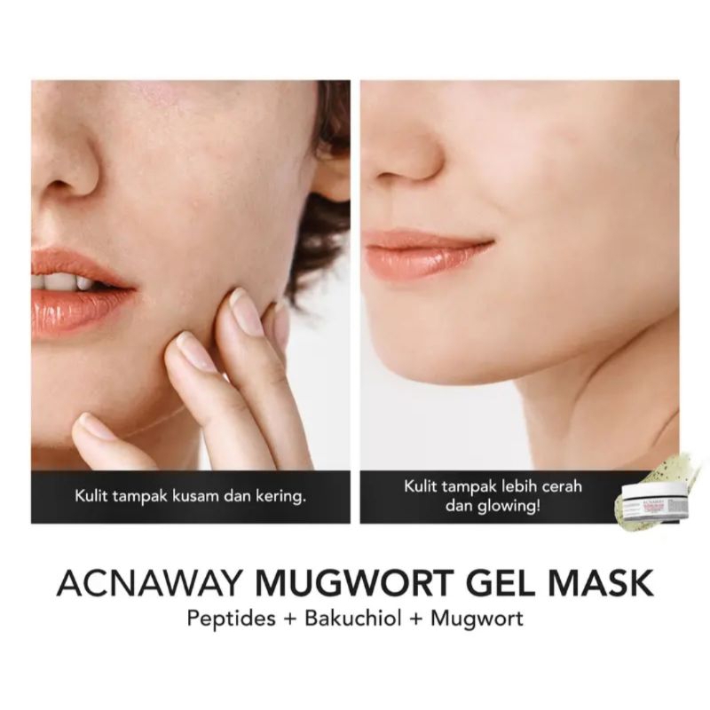 ACNAWAY 3 in 1 SUNSCREEN MUGWORT GEL MASK ACNE PATCH STIKER MASKER JERAWAT SERUM FOR ACNE PRONE SKIN SKEENEEDS Hyaluronic Acid Sunscreen face and body Spray / Mist 60ml moisturizer water gel mugwort facial wash