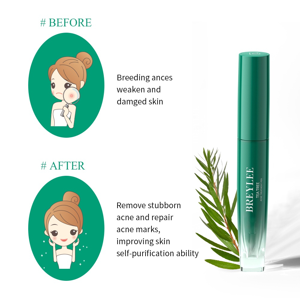 ✨ AKU MURAH ✨ BREYLEE TEA TREE ACNE TREATMENT PEN - ORIGINAL