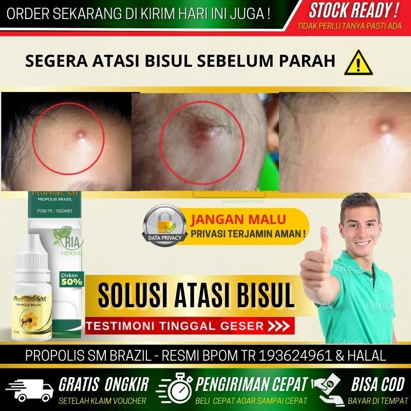 Obat Bisul Di Kepala, Obat Bisul Kecil Kecil Di Kepala, Obat Borok Di Kepala Alami Biar Cepat Kering