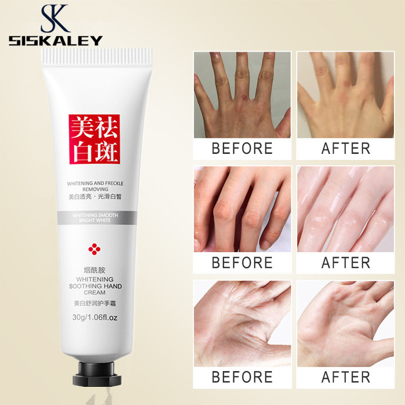 SISKALEY 30g Niacinamide Hand Cream Anti-Chafing Repair Soften Whitening Moisturizing Hand Cream
