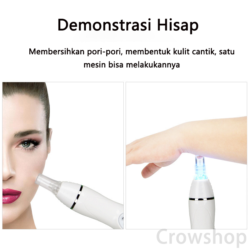 ✨ 100%Ori &amp; Garansi✨ 2 in 1 Diamond Peeling Vacuum Penyedot Komedo Diamond Peeling Blackhead Remover Instrumen Pembersih Wajah Kecantikan Listrik Pembersih Instrumen Blackhead