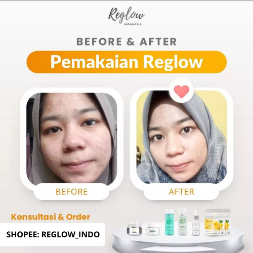 Reglow 2PCS Night Cream + Serum Rglow Skincare Dokter Shindy Original Official Store