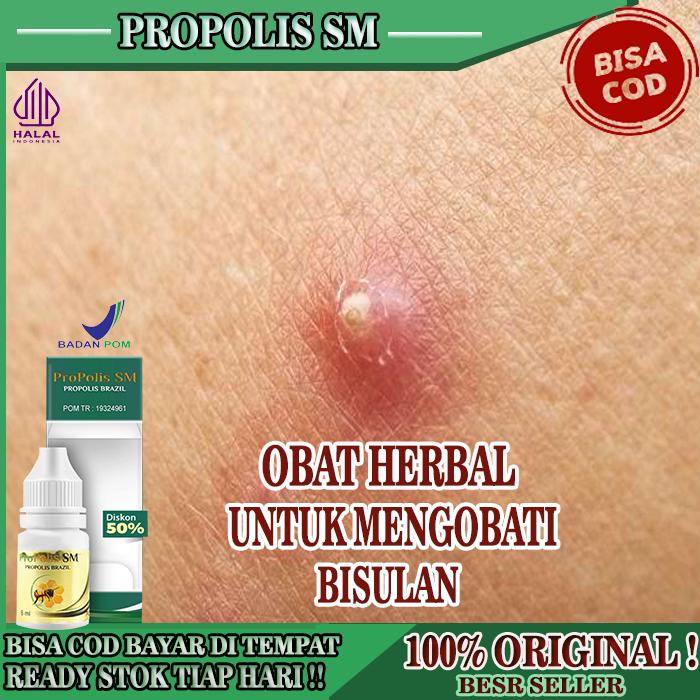 Obat Bisulan, Obat Gatal, Bisul, Obat Bisul Bernanah, Obat Bisul Alami, Obat Oles Untuk Kulit Bisul,