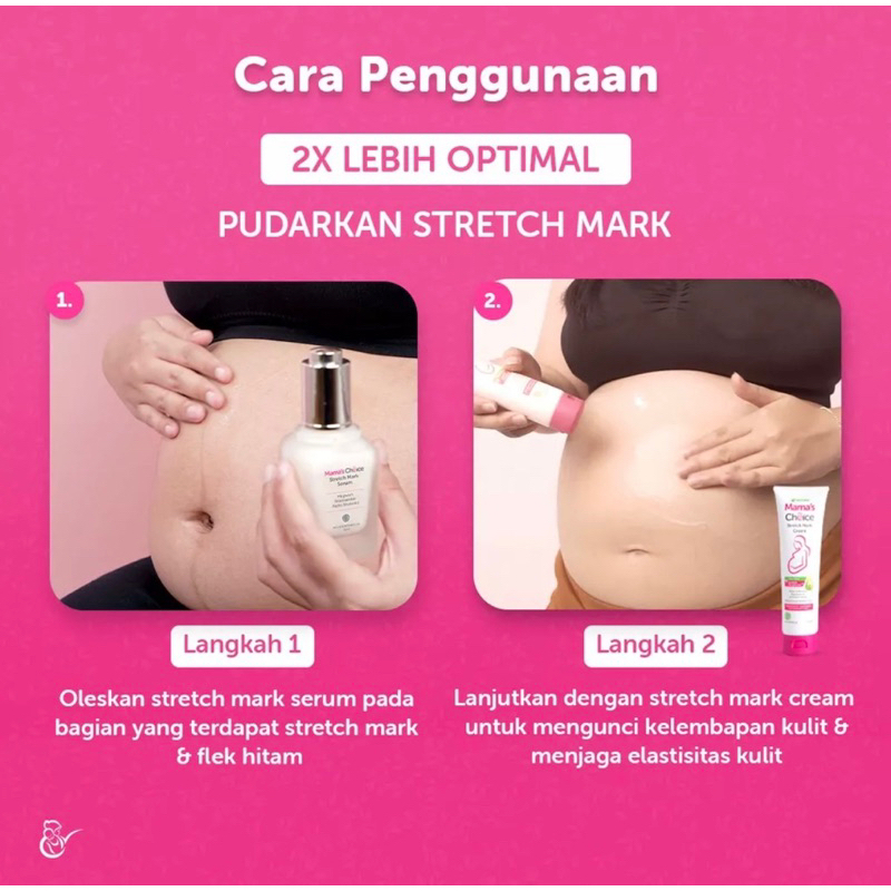 Mama’s Choice Stretch Mark Serum 50 ml Mamas Choice Serum Penghilang Stretch Mark