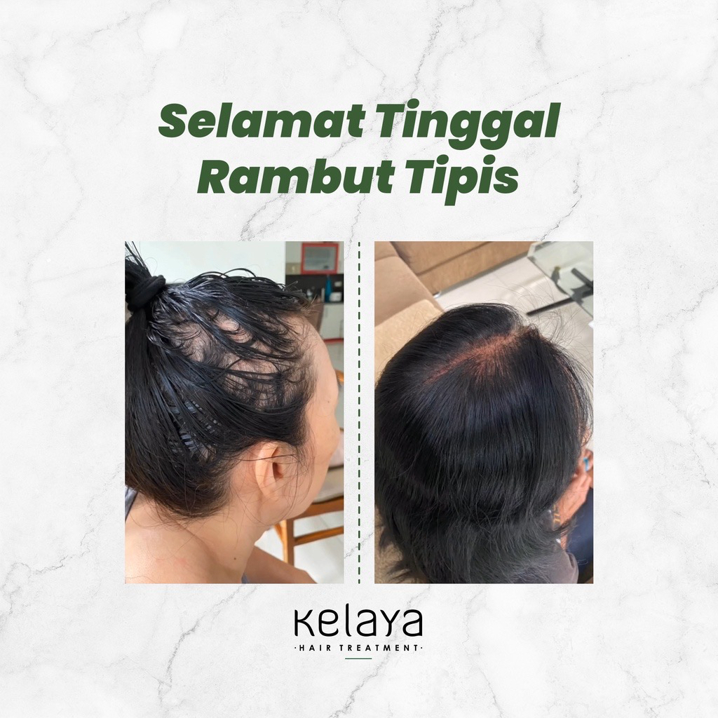 ￼Original 100% Shampo Kelaya Hair Threatment Sampo Penumbuh Rambut Atasi Rontok Ketombe Ori