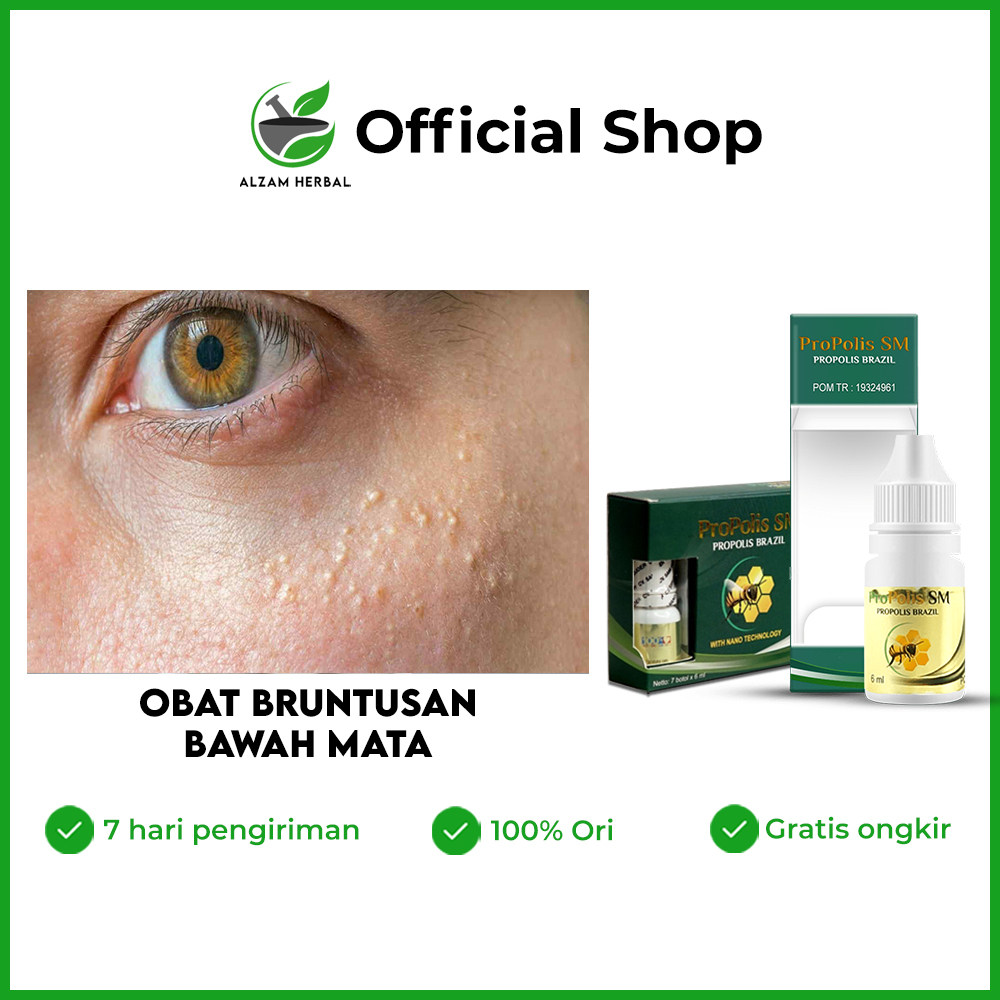 Alzam Herbs - Propolis SM, Obat Bruntusan di Bawah Mata, Obat Bintik di Bawah Mata, Obat Millia di B