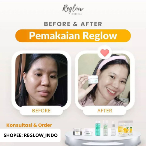 Reglow Skincare Original dr Shindy Pemutih Wajah Ori Dan Cepat Glowing Untuk Kulit Sensitif Kering Kusam Red glow Official Store