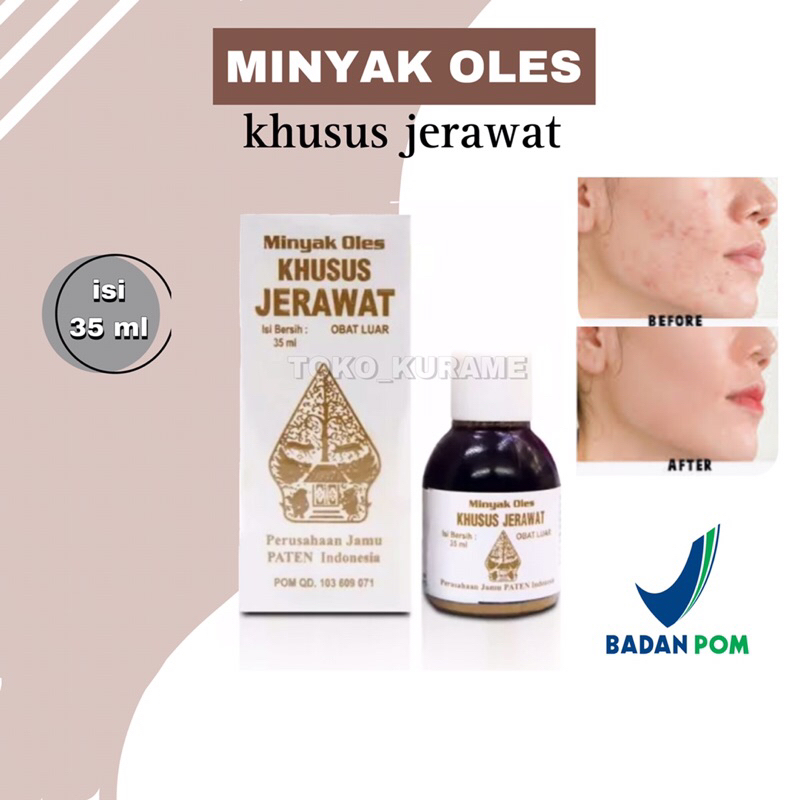 ORIGINAL! Minyak Oles Khusus Jerawat Cap Wayang terbaik / Obat Jerawat  / Penghilang Jerawat