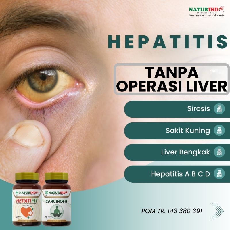 Obat Hepatitis Akut  Sirosis Infeksi Virus Alami