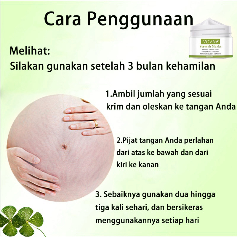 Stretch Mark Cream Mama Choice Stretch Mark 30ml  Stretch Mark Dan Obesity Mark Krim Mengencangkan Perut Stretch Mark Removal Cream Krim Perawatan Postpartum