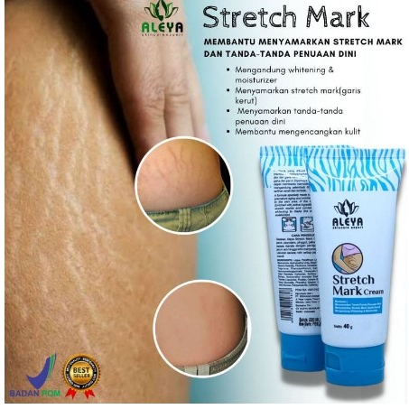 Cream Penghilang Bekas Luka Keloid Obat Strechmark Obat Penghilang Selulit Bpom Lhosiya Ampuh