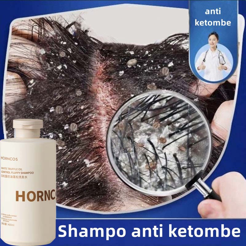 Shampo Anti Ketombe Balsem Shampoo Buat Ketombe Hampoo Penghilang Ketombe Anti Gatal Pengobatan Ketombe