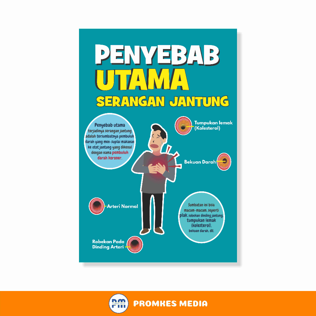 

Poster Kesehatan, Penyebab Serangan Jantung