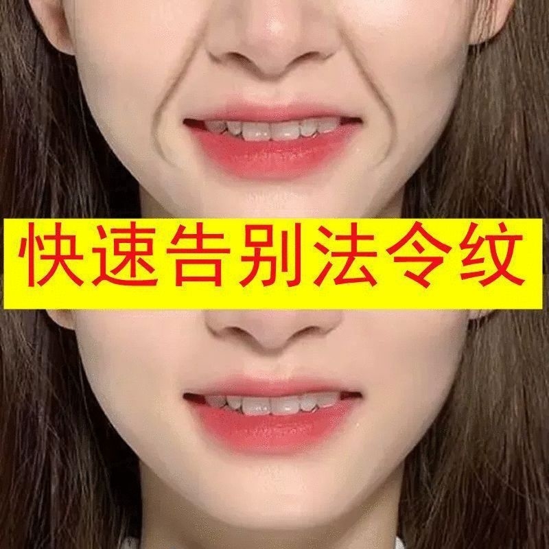 Masker Garis Senyum Pipi Smile line V Shape Seomu isi 5 pasang