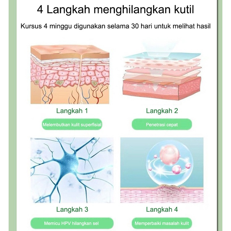 Krim kutil obat penghilang kutil penghilang kutil 20g skin tag remover Menghilangkan kutil, tahi lalat, berbagai skin tag di berbagai bagian tubuh