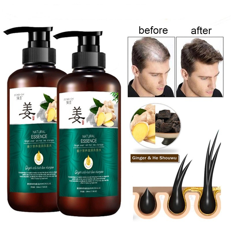 Shampo Jahe Anti Rambut Rontok / Shampo Penumbuh Rambut Cepat / Anti Ketombe dan Gatal / Shampoo Perawatan / Ginger Shampoo 500ML