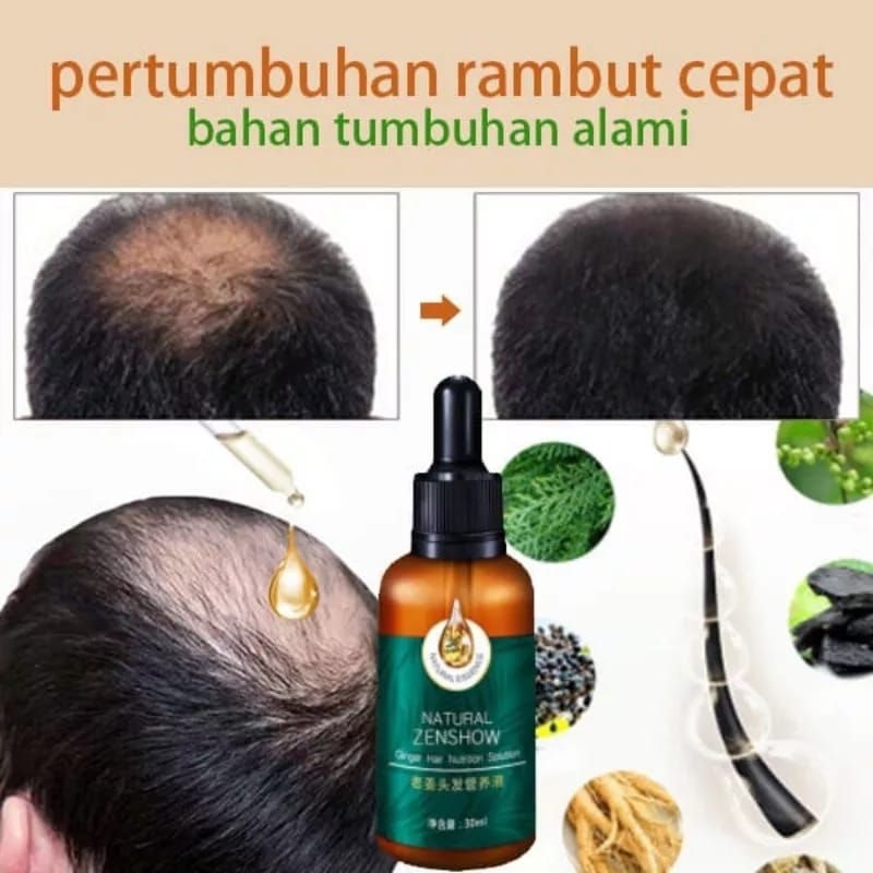 GINGER HAIR GROWTH ESSENCE HAIR SERUM PENUMBUH RAMBUT ANTI RONTOK TERBUKTI  1000%