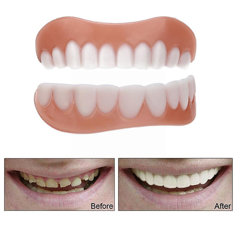 Gigi Palsu Instan Perfect Smile Veneer Gigi Tiruan Instan Atas Bawah Lepasan Atas Bawah Snap On Smile Dewasa Kuat Veneer Silikon