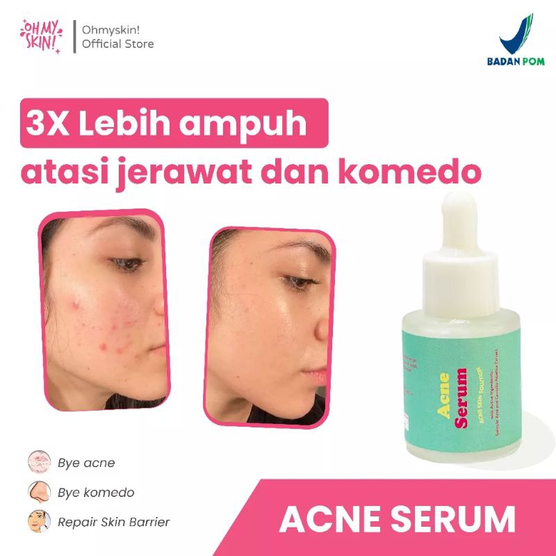 acne serum ohmyskin (atasi jerawat dan komedo)