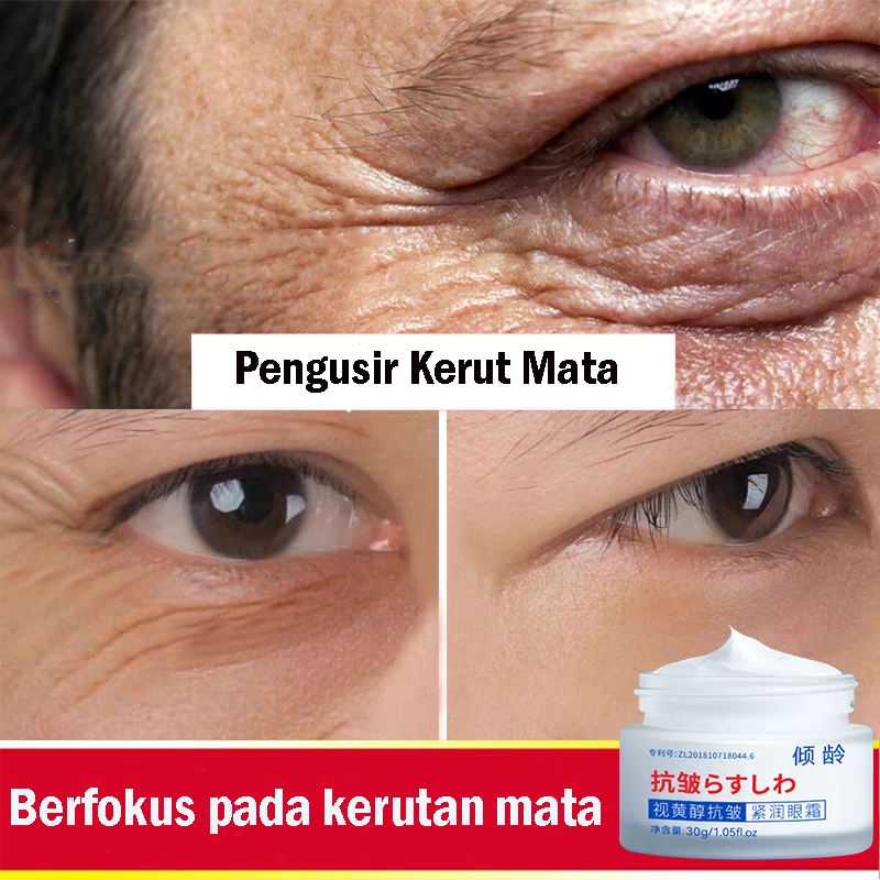 Retinol Anti-Kerut Mengencangkan Krim Mata  krim mata panda krim mata penghilang kantung mata 30g Mengangkat Kerut Mata &amp; Mengencangkan Area Mata memudar lingkaran hitam Hidrasi dan Pelembab memperbaiki keriput mata