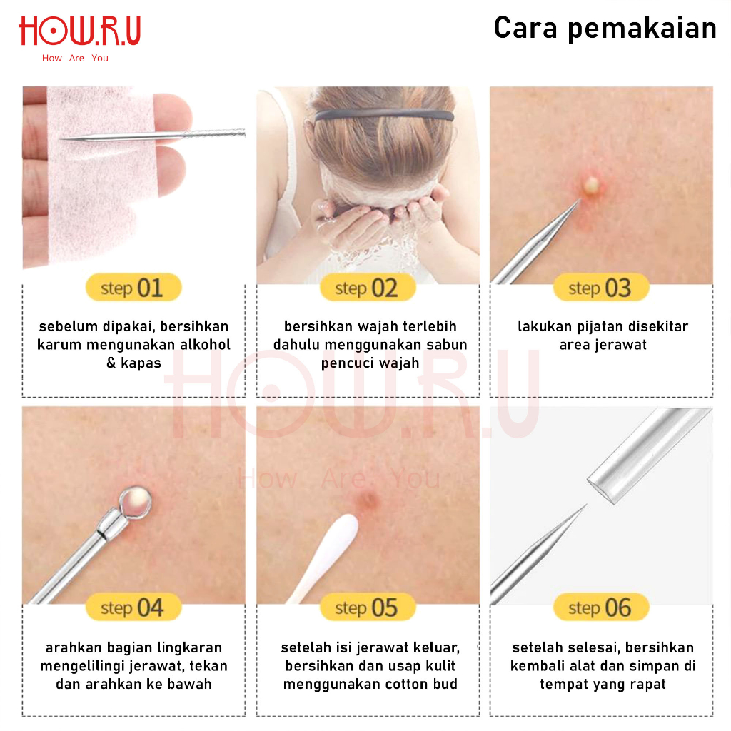 HOW.R.U | Jarum Ekstraktor Angkat Jerawat dan Komedo Stainless Steel