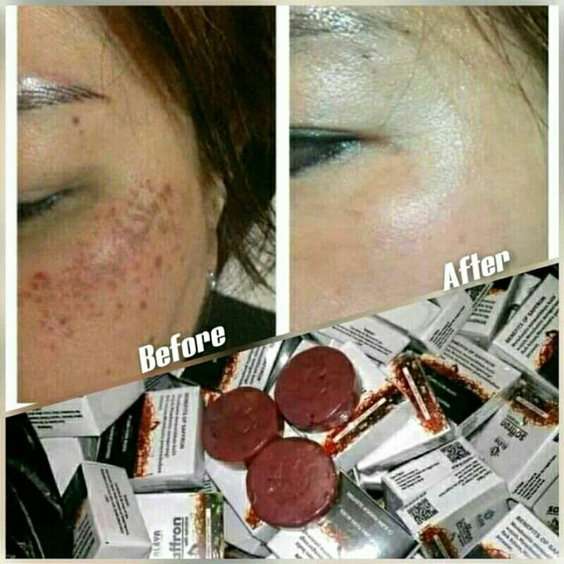 Sabun Saffron Spirulina by Aleya Sabun Flek Hitam membandel Sabun Jerawat BPOM Sabun Pemutih Origina