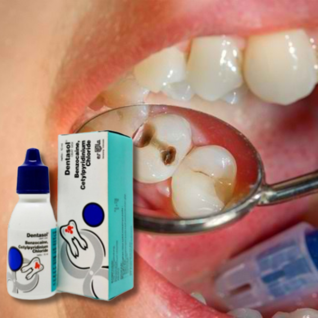 dentasol obat sakit gigi dan gusi berlubang untuk anak anak dan dewasa, obat tetes cair untuk meyemb