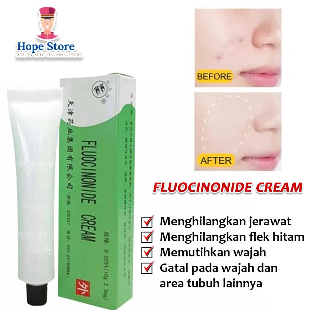 Hope Store - Salep Walet Penghilang Flek Hitam Membandel Fluocinonide Cream / Salep Gatal Kulit Paling Ampuh