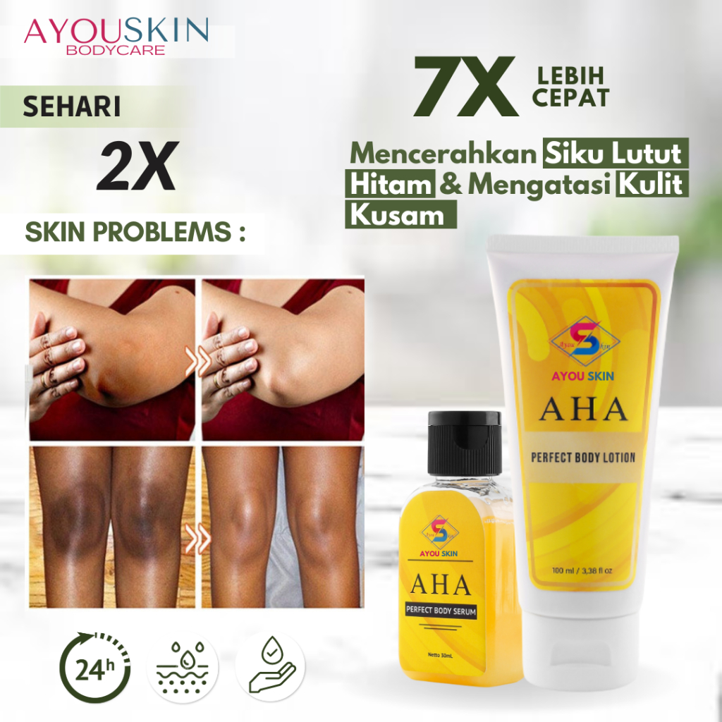Body Lotion Pemutih Siku Krim Pencerah Pemutih Lutut Kaki Cream Pemutih Dengkul, Lotion Pemutih Siku