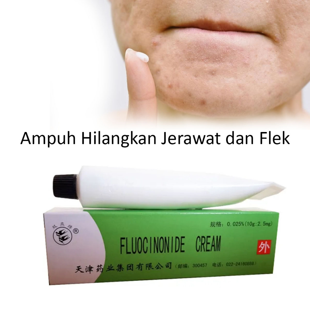 Fluocinonide Cream - Salep Kulit Gatal Ruam Kemerahan Efektif
