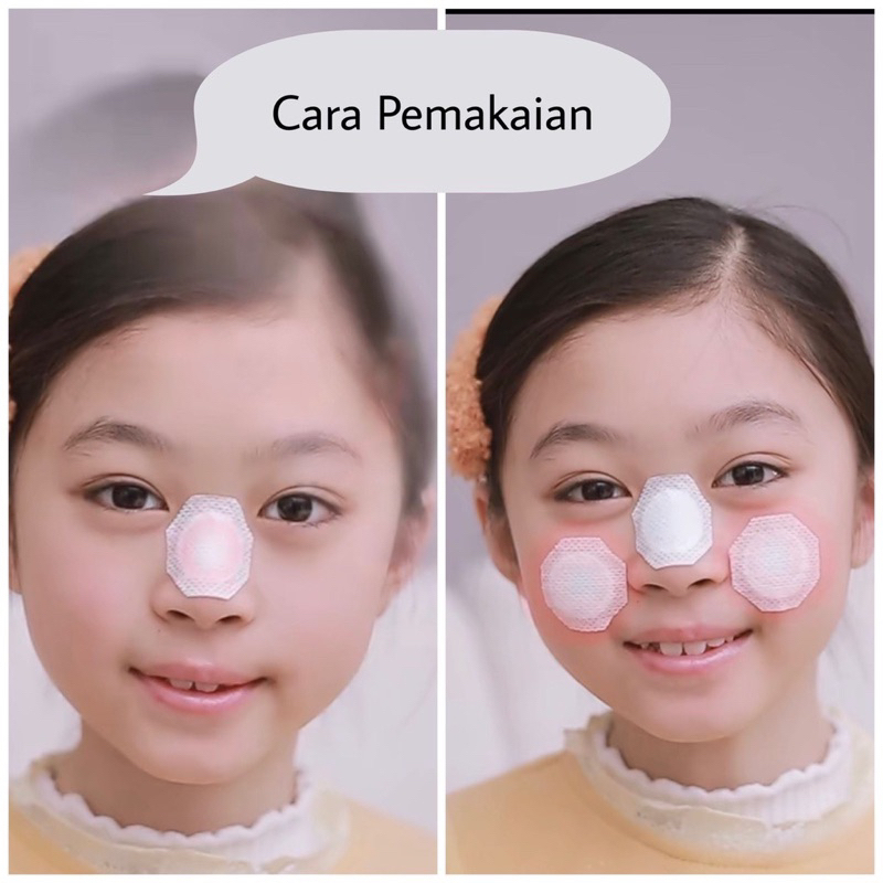 Koyo Hidung Alergi Sinus Pilek Bayi Anak Dewasa Herbal Stiker Hidung Gatal Bersin