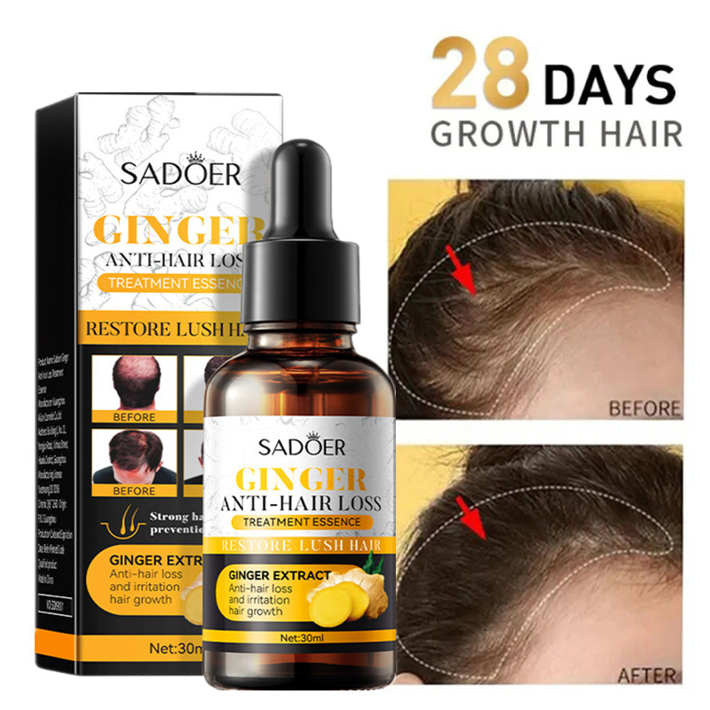 Hair Growth Fluid Ginger Fast Hair Growth Serum Repair Damaged Hair Conditioner  Anti-Hair Loss Promotes Hair Growth